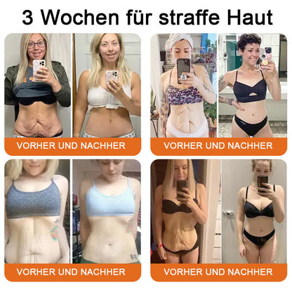 "Hergestellt in Deutschland, Versand aus Deutschland|✅ Offizieller Store✨Purelora® Bienengift Regenerationscreme 🔥 LETZTER TAG 80% RABATT💎"