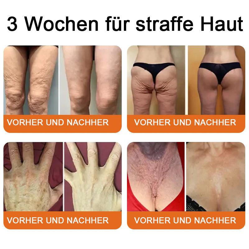 "Hergestellt in Deutschland, Versand aus Deutschland|✅ Offizieller Store✨Purelora® Bienengift Regenerationscreme 🔥 LETZTER TAG 80% RABATT💎"