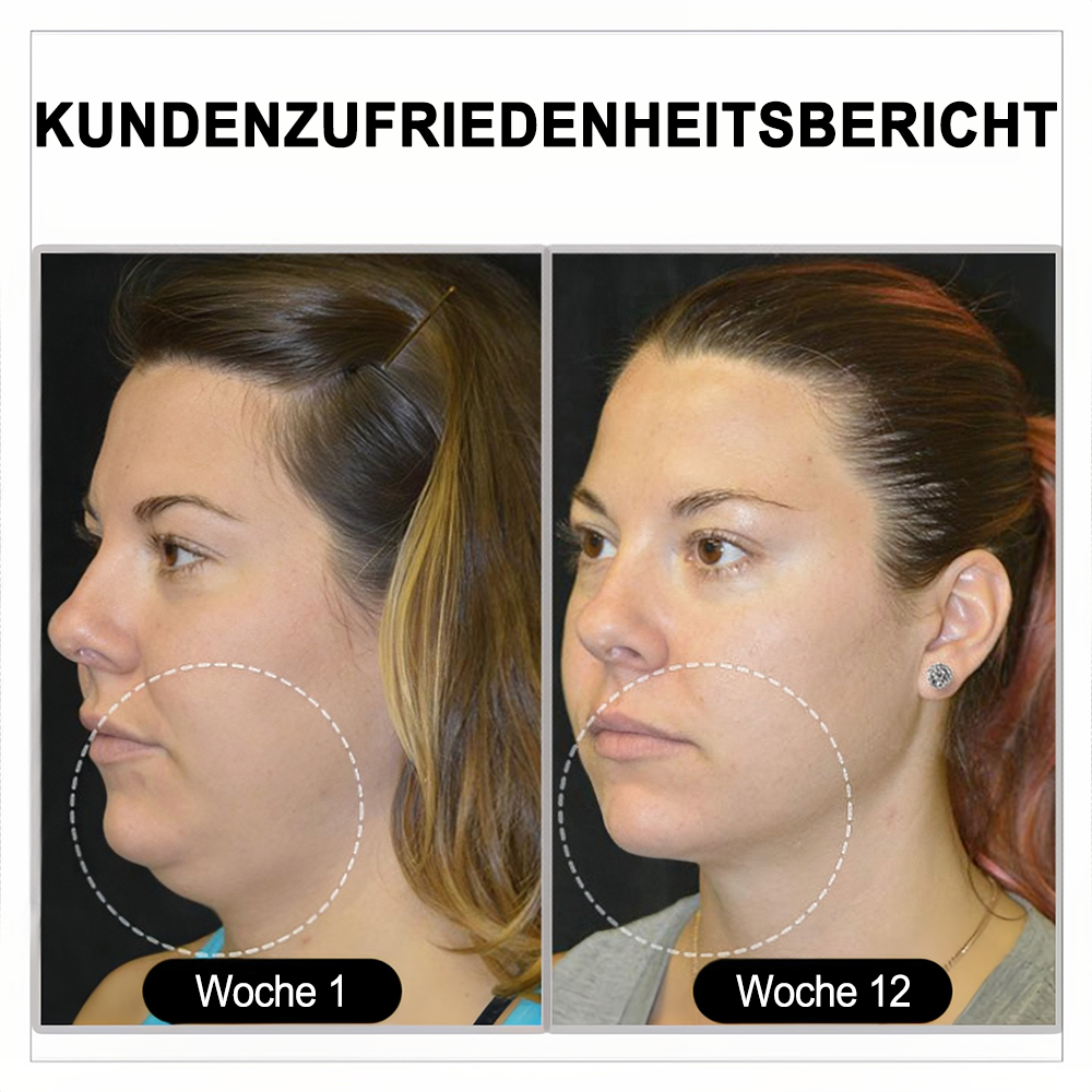 (🌷LETZTER TAG – 80 % RABATT) 🎉 Czticle® Histone Magnetologie Lymphvity Germanium-Ohrringe