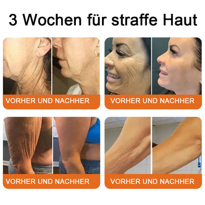 "Hergestellt in Deutschland, Versand aus Deutschland|✅ Offizieller Store✨Purelora® Bienengift Regenerationscreme 🔥 LETZTER TAG 80% RABATT💎"