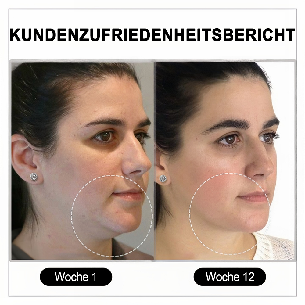 (🌷LETZTER TAG – 80 % RABATT) 🎉 Czticle® Histone Magnetologie Lymphvity Germanium-Ohrringe