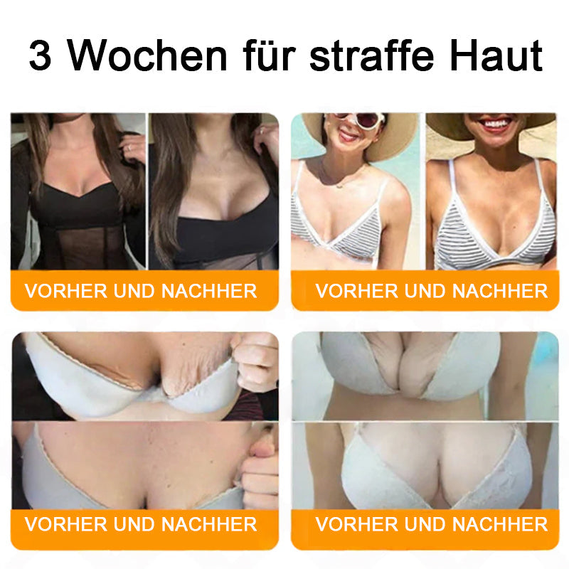 "Hergestellt in Deutschland, Versand aus Deutschland|✅ Offizieller Store✨Purelora® Bienengift Regenerationscreme 🔥 LETZTER TAG 80% RABATT💎"