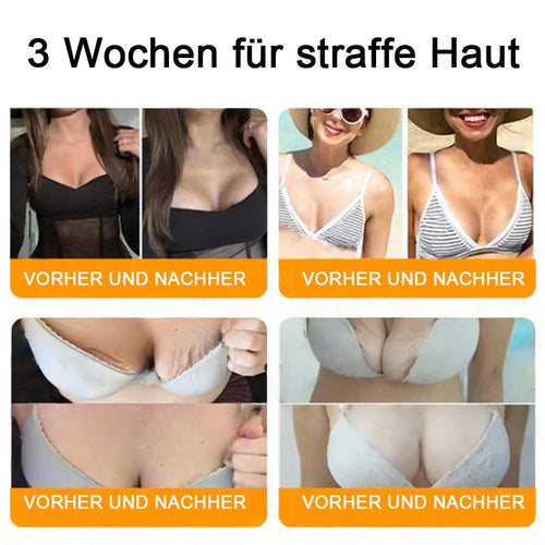 "Hergestellt in Deutschland, Versand aus Deutschland|✅ Offizieller Store✨Purelora® Bienengift Regenerationscreme 🔥 LETZTER TAG 80% RABATT💎"
