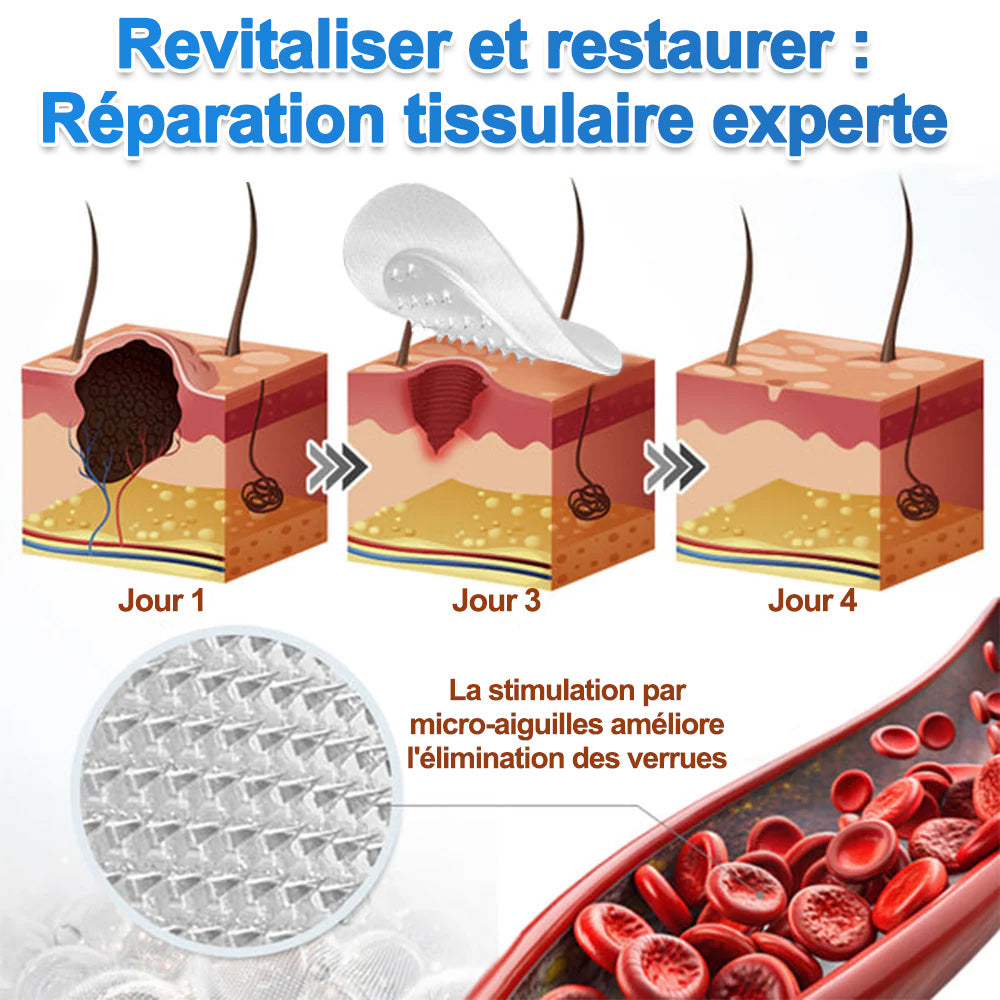 ✨Patch 2-en-1 Purelora® : Microneedle & Hydrocolloïde🍀 | Élimine les grains de beauté en relief, les verrues planes et les acrochordons | Aide à atténuer les rides, les cicatrices et les imperfections | Patch invisible adapté au visage et au corps