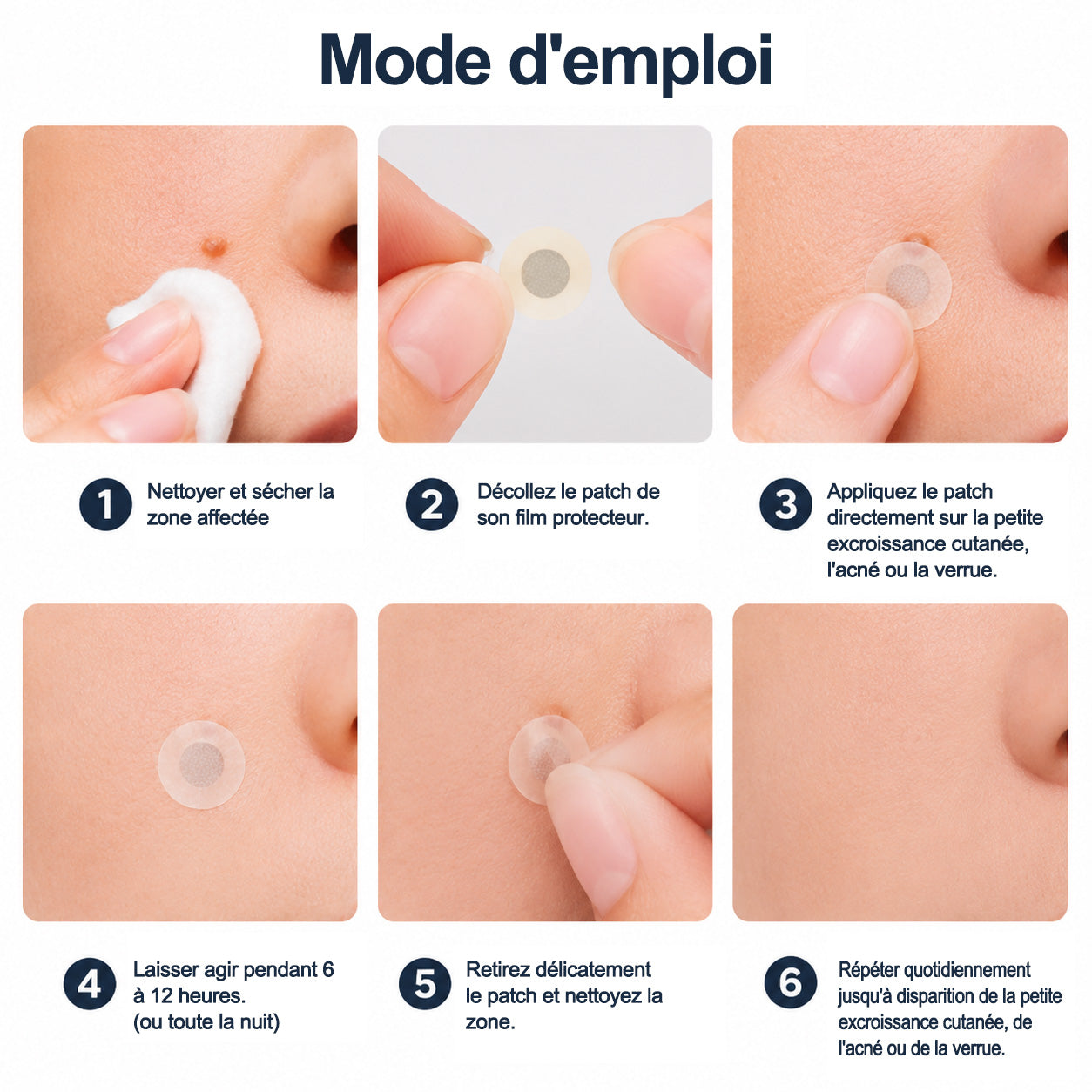 ✨Patch 2-en-1 Purelora® : Microneedle & Hydrocolloïde🍀 | Élimine les grains de beauté en relief, les verrues planes et les acrochordons | Aide à atténuer les rides, les cicatrices et les imperfections | Patch invisible adapté au visage et au corps