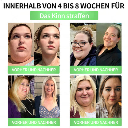 💖𝑶𝒏𝒍𝒊𝒏𝒆-𝑨𝒑𝒐𝒕𝒉𝒆𝒌𝒆💖 | 🌱 Purelora® 10-in-1 Natürliches Inhaltsstoffe Nano-Mikronadel-Pflaster ✅ Unterstützt Gewichtsmanagement, Herz-Kreislauf-Gesundheit, Blutzuckerbalance, Schlaf, Darm- & Gelenkfunktion – strafft die Haut und steigert die Energie.