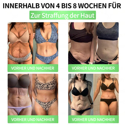 💖𝑶𝒏𝒍𝒊𝒏𝒆-𝑨𝒑𝒐𝒕𝒉𝒆𝒌𝒆💖 | 🌱 Purelora® 10-in-1 Natürliches Inhaltsstoffe Nano-Mikronadel-Pflaster ✅ Unterstützt Gewichtsmanagement, Herz-Kreislauf-Gesundheit, Blutzuckerbalance, Schlaf, Darm- & Gelenkfunktion – strafft die Haut und steigert die Energie.