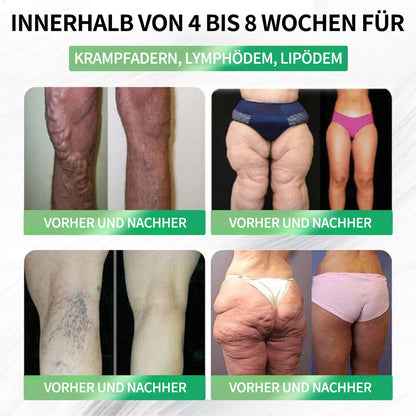 💖𝑶𝒏𝒍𝒊𝒏𝒆-𝑨𝒑𝒐𝒕𝒉𝒆𝒌𝒆💖 | 🌱 Purelora® 10-in-1 Natürliches Inhaltsstoffe Nano-Mikronadel-Pflaster ✅ Unterstützt Gewichtsmanagement, Herz-Kreislauf-Gesundheit, Blutzuckerbalance, Schlaf, Darm- & Gelenkfunktion – strafft die Haut und steigert die Energie.