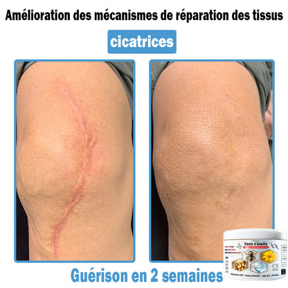 (⏰Promotion limitée : –60 % — Plus que 30 minutes ⏰)
