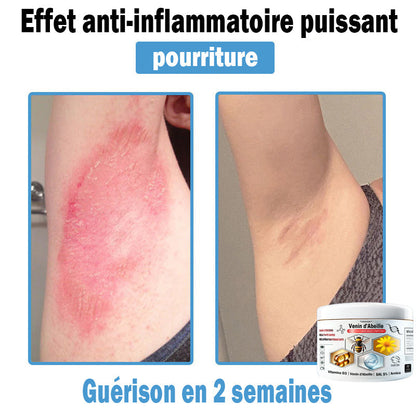 (⏰Promotion limitée : –60 % — Plus que 30 minutes ⏰)