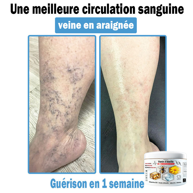 (⏰Promotion limitée : –60 % — Plus que 30 minutes ⏰)