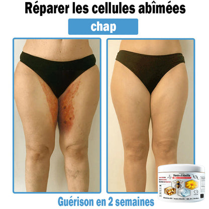(⏰Promotion limitée : –60 % — Plus que 30 minutes ⏰)